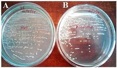 Revealing Probiotic Potential of Enterococcus Strains Isolated From Traditionally Fermented Chhurpi and Healthy Human Gut